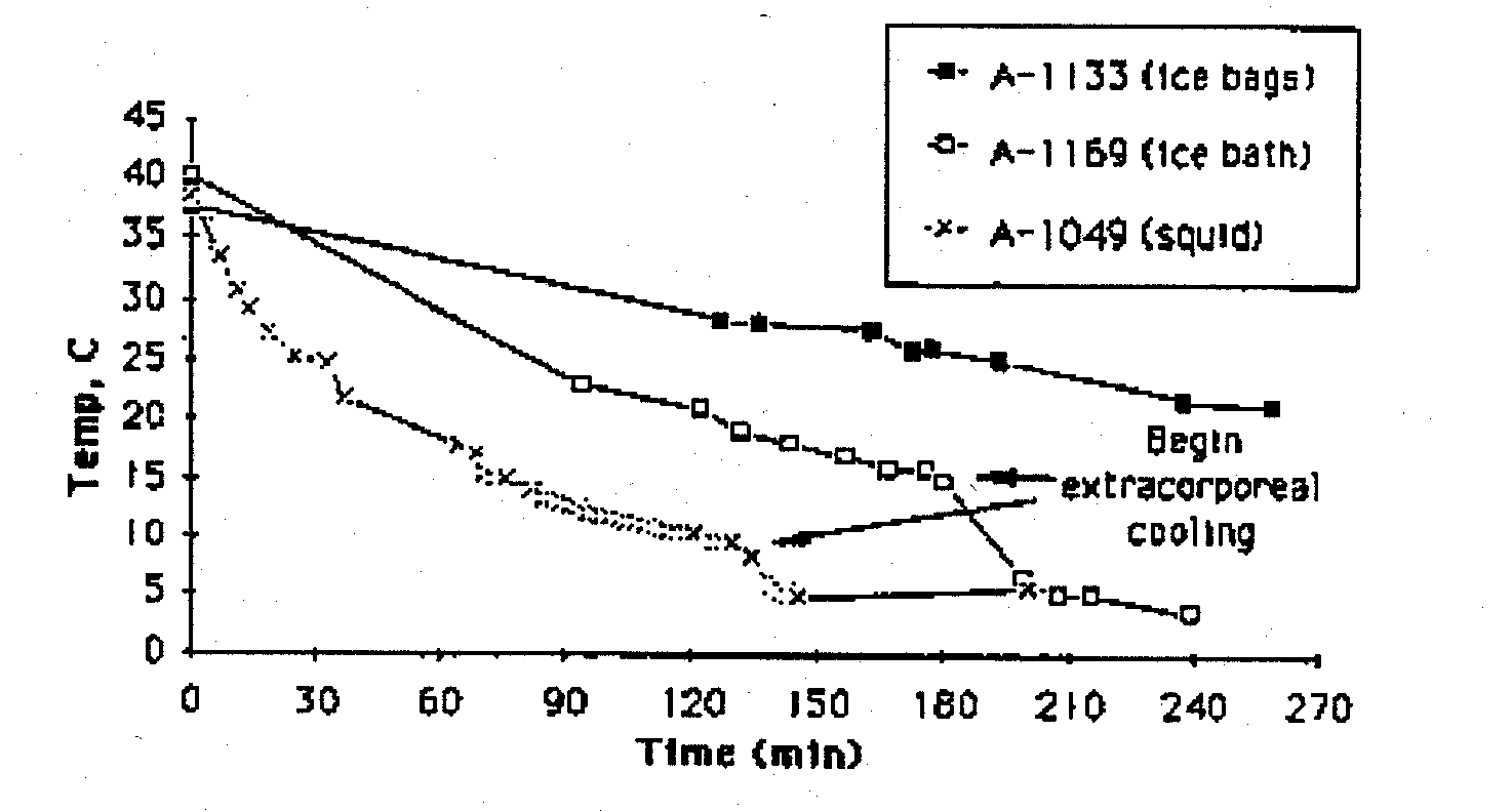 Body Temperature After Death Chart