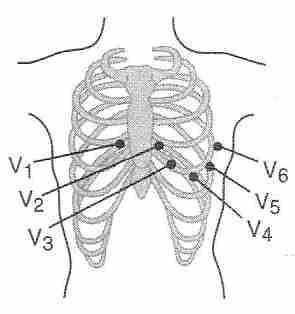 ELECTROCARDIOGRAPH (ECG,EKG) INTERPRETAION