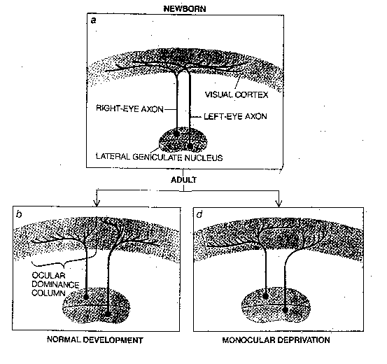 [Brain development in eye occlusion]