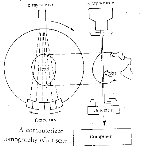 [CAT scans (= CT scans)]