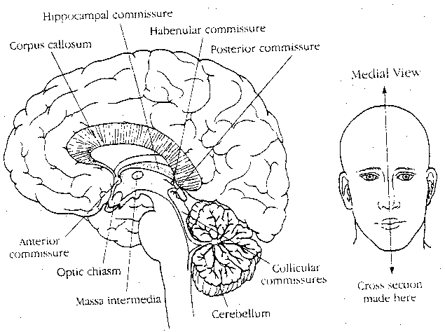 Cerebral Commissures, Medial View